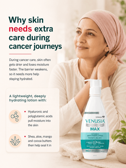 Venusia Max Moisturising Lotion, Deep Hydration for Normal to Dry Skin (300 gm)