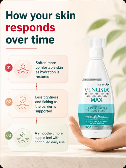 Venusia Max Moisturising Lotion, Deep Hydration for Normal to Dry Skin (300 gm)